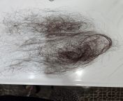Is this a reasonable amount of hair loss? from indan hair veda