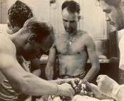 In 1942 aboard USS Silversides (SS 236), Pharmacist&#39;s Mate 1st Class Thomas Moore performed an emergency appendectomy on Fireman 3rd Class George Platter, using galley spoons to hold the incision open and a can of ether as anesthesia. The operation wa from 14 x bf com ss lon