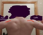 Uneven muscle growth from computer link muscle growth