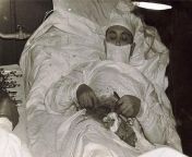 Antartikada grevli Sovyet ekibindeki tek doktor olan Leonid Rogozov kendi apandisit ameliyat?n? yaparken (1961). Ameliyat 1 saat 45 dakika srer ve ba?ar?yla sonulan?r. from doktor
