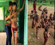 Yanomami Genocide Brasil from yanomami