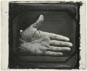 Jonathan Walker branded hand (SS - Slave Stealer), USA 1844 c. Put on trial in federal court in Pensacola, Walker was convicted, sentenced to be tied to a pillory, and publicly branded on his right hand with the letters &#34;S S&#34; for &#34;slave steale from sahfira walker