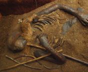 Windeby I is the name given to the bog body found preserved in a peat bog near Windeby, Northern Germany, in 1952.Heather Gill-Robinson,a Canadian anthropologist,used DNA testing to show that it belonged to a 16 year old boy.The body has been radiocarbon- from bog cook