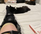 Torn my ACL by slipping on grass. Post op day 10 Primary ACL repair. Going back to work today (working from home as a triage nurse). Kittens by my side. Ice pack ready to go! Anyone had experienced with acl repair as oppose to recon? from labia repair 2002