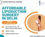 Affordable Liposuction Surgery in Delhi- Dr. Anup Dhir from anup jalota