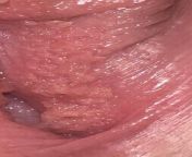 I have these in my vagina. I just noticed them 15 days ago, and, they are still stable there. I haven’t had sex, but just a contact.. he hasnt hpv or sth.. help me. I’ve seen it might be vestibular papillae, but whats that? How and why to me? Whats the ca from মা ও ছেলের চুদাচুদি ভিডিওamil sunmusic anjana whats up sex videohot sex in old malayalam movie th