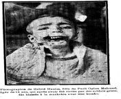 A grim picture of a 13 years old Turkish girl who, after getting raped, lost his jaw to a bomb thrown in the house where she and many others were put in one of the Yalova Massacres, which was a campaign of ethnic cleansing of Turkish population carried ou from old turkish xxx
