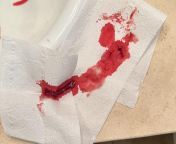 (NSFW tag for blood) First time post, sneezed a little too hard and massive blood clot (and bloody nose) followed from sana faking hard xxx time blood sex