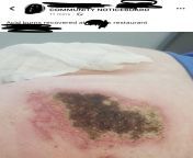 SOMEONE HAS POSTED A PICTURE OF THEIR NASTY ASS ON A FACEBOOK LOCAL COMMUNITY PAGE WHAT LOL from new facebook local xnx viral