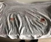 (NSFW) Tried running without a bra to avoid heat rash, but this happened. (Yes, thats my shirt after the run, and yes, thats blood from my nipples.) Any ladies have similar issues and found out how to avoid heat rash AND bad nipple chaffing? from www xxx kajal sixxx video kajal leone avoid