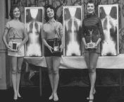Miss Correct Posture, 1956. At a chiropractic convention in May of 1956 in Chicago, the contest winners were picked for the beauty of their X-rays and their standing posture. from tbm robbie beauty of boy model
