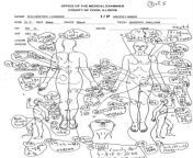 Kts Dre Autopsy Report from autopsy mayat dan analysis bahagian