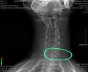 My dog&#39;s x rays from actress nagma nude x rays