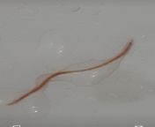 I found this worm like thing in my shower i just wanted to make sure if this is a normal one or is it a medical problem , thank you from cawley medical media