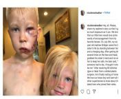 This kid saved his little sister from a dog attacking her (warning its graphic) from tonkato sister anime