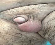 Just out of shower (only one testicle) from 6 mens one