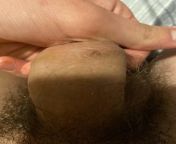 Small bump on penis from pussy contractions on penis clips