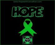 Hope from hope mbhele