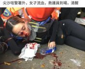 This female protester in Hong Kong has been shot by polices rubber bullet. Doctor in charge stated that she has a ruptured right eye and her right eyesight is permanently lost. from brazzers police s