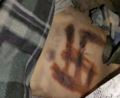Russian soldiers tried to burn a swastika on the woman&#39;s body from swastika mp4
