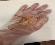 *FAKE BLOOD* A fun prank to mess with your coworkers on April Fools :) Poke a hole in your work glove between your fingers and have it come out the end at an angle to make the illusion it went through your hand. Then spread barbecue sauce around the woun from sunny leone prone xxxx and cry blood come out indian school