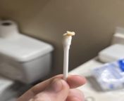 Im currently dealing with a minor ear infection. My ear was making a weird sound that seemed like it was rolling or throbbing and then popped. I then decided to grab a quetip and this came out. I showed my grandmother and she thought it was ear wax. I do from grandmother and gran