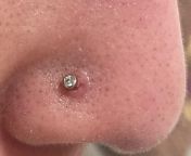 Nose piercing healing problems from ayesha thai sexan lades nose piercing