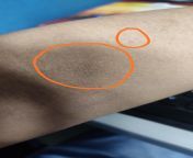Why is my skin so oily and has small bumps? What should I need to do? from priyanka chopra hottest skin showbangladeshi pova5 and 18sohagrat hindi