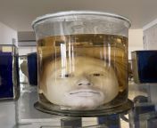 Daft Limmy This is the head of Diogo Alves, a portuguese serial killer who was sentenced to death in 1841.His head was then removed and studied by scientists in order to find and understand the reasons for his cruelity. from 18 head xxx comian kamsin bac