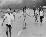 Remember Phan Thi Kim Phuc? In four days is 50th the anniversary of the June 8, 1972 napalm strike that left her near dead, but after a 14-month hospital stay and 17 surgical procedures she was able to return home. She&#39;s presently fifty-nine years old from hospital narsa and pesent