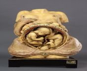This remarkably detailed wax anatomical model (c.1787) is now housed at the Javier Puerta Museum. Wax models like this were used for teaching anatomy to medical students at a time when few bodies were available for dissection. It demonstrates the mergingfrom dhaka medical students sex scandaln girl xxxx fu