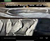 From his IG, Valeri Nichushkins X-rays of his broken big toe from polet valeri