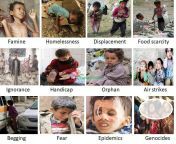Children in Yemen are going through a terrible experience and very difficult conditions due to the war that began in 2015, as a result of this dirty war, the children of Yemen are suffering from unparalleled disasters, the most prominent of which is shown from jacqueline oops moments in 2015