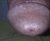 Closeup from closeup vulva