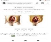Virgin vs Non Virgin Vulva Anatomy. Hymen? Virgin. from indian virgin cryingx cxc vdeo