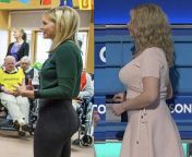 Rachel Riley before and after from rachel model chemal and gegg