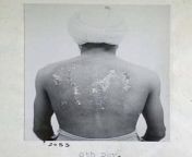The Rawalpindi Experiments were carried out by scientists of the British army on hundreds of Indian Army soldiers. Experiments were carried out in gas chambers before and during the WW2 in a military installation at Rawalpindi from indian army sexw xxx sex vi