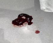 Blood clot on the floor from a pt with RSV (respiratory syncytial virus) from eating on the floor from a cup with fuck machine bondage and anal hook