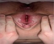 here you can almost see my virgin hymen! im so tight its hard to open me further ? from virgin hymen deflo