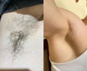 Hairy or hairless axils?? from jensen axils
