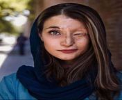 Marzieh Ebrahimi, an Iranian survivor of an unprovoked acid attack in 2014 for wearing a &#34;bad hijab&#34;. from amir ebrahimi