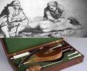 The tobacco smoke enema, an insufflation of tobacco smoke into the rectum by enema, was a medical treatment employed by European physicians for a range of ailments. from enmarotica stonefox enema
