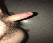 Looking for a sugar daddy thats into hairy babys ? from hairy baby hd