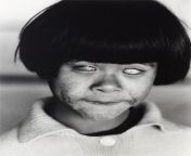 The eyes that saw the end of the world, 1945. A picture of a blind Japanese girl who lost her sight due to witnessing the atomic bomb attack on Hiroshima on August 6th, 1945. from 49图库 资料网址👉【1945 cc】band