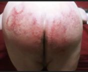 The best spanking of my life. I was bruised for a month from spanking of youku