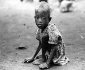 [History] A child affected by the Biafran War, in Nigeria, in the late 1960s. from biggest boob in nigeria naked