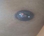 Is my piercing in my breast or nipple? I think the bar is too short as well. I&#39;ve had the piercing since July but the bump showed up a month ago. from female niddle piercing in vagina closeup