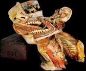 Dissection of the head and neck, c. 1851. from 黑森州怎么找高雅的小姐）123薇信咨询网址▷em22 cc125黑森州怎么找小妹小姐多的地方 黑森州哪里有美丽的小姐） 1851