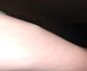 Sudden big lump forming on arm?? Its bruising with it, Feels like its on fire and hands turning red n warm from tamil wife riding on hubby and fucking with moaning n tamil audio