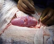 For two days, scientists hooked up the kidney of a genetically engineered pig to a brain-dead woman on a ventilator to see if the kidney would work. It did. from dead woman sex morgue